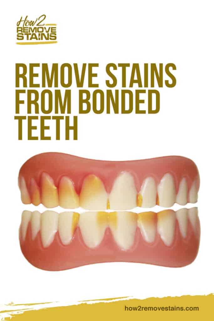 How to Remove Stains from Bonded Teeth [ Detailed Answer ]