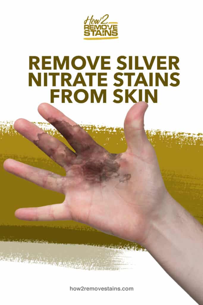 how-to-remove-silver-nitrate-stains-from-skin-detailed-answer