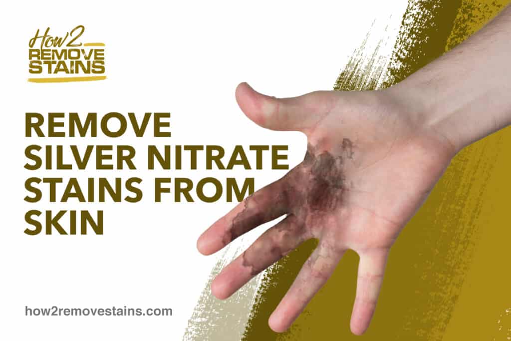 how-to-remove-silver-nitrate-stains-from-skin-detailed-answer