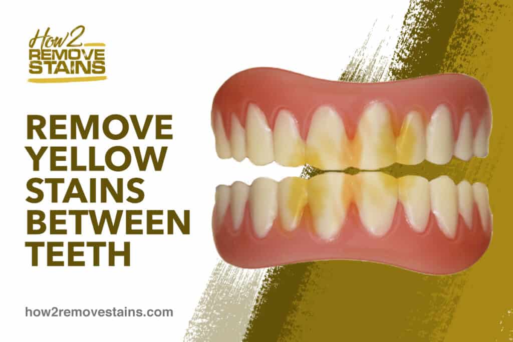 how-to-remove-yellow-stains-between-teeth-detailed-answer