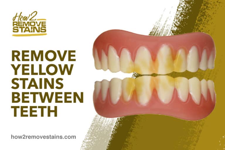 How to remove yellow stains between teeth [ Detailed Answer ]