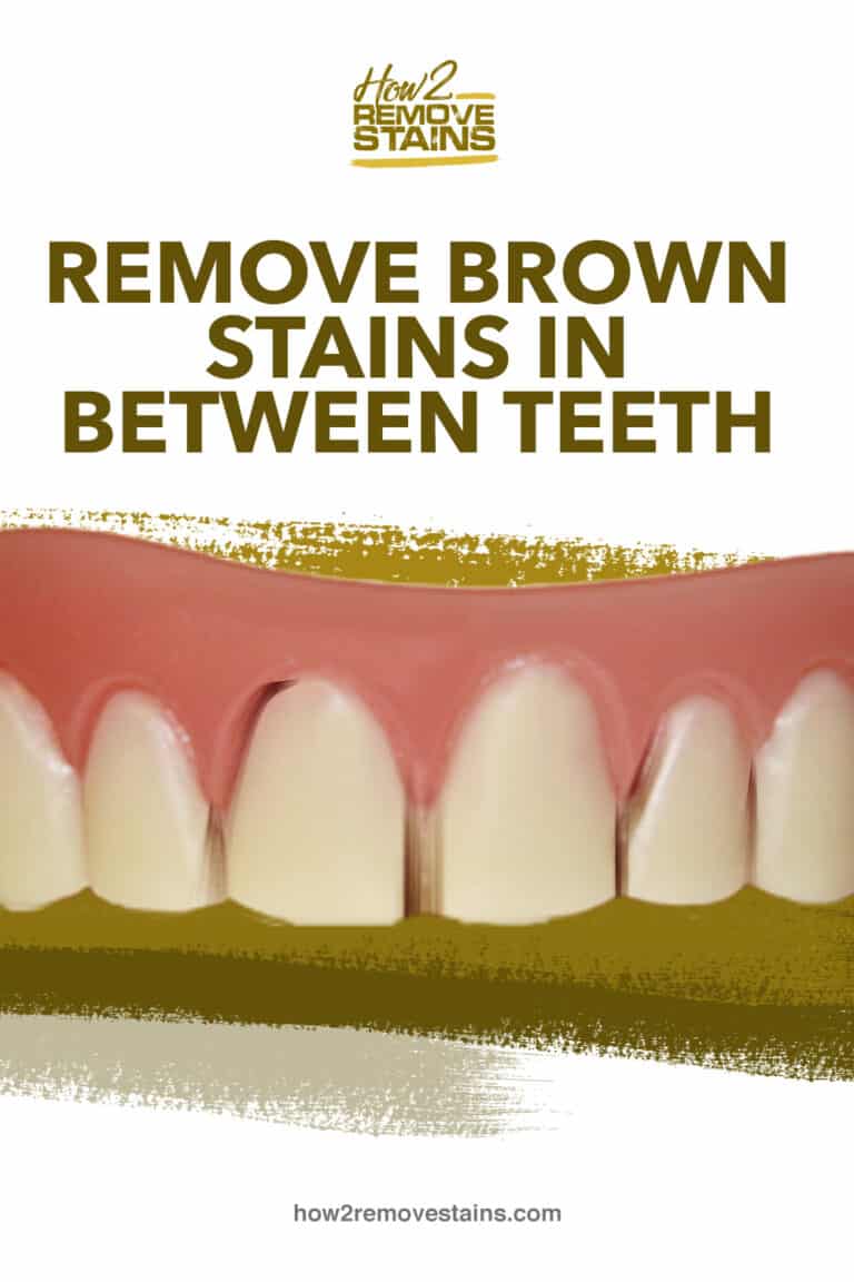 how-to-remove-brown-stains-in-between-teeth-detailed-answer