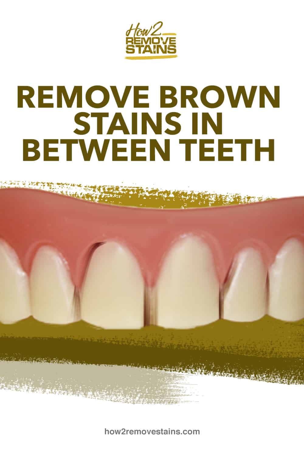 How to remove brown stains in between teeth [ Detailed Answer ]