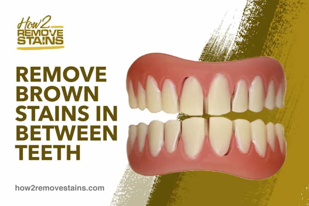 does baking soda remove brown stains on teeth