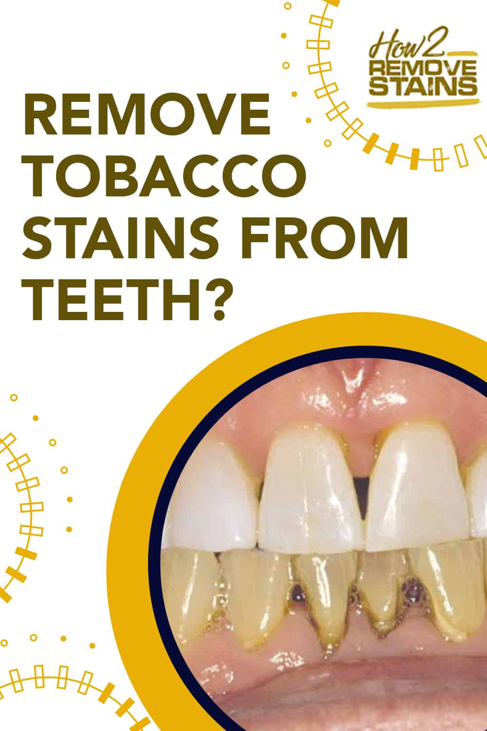 how-to-remove-tobacco-stains-from-teeth-detailed-answer