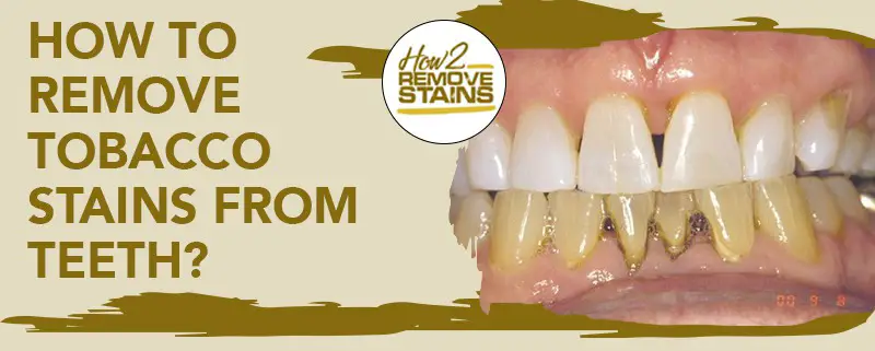 how to remove tobacco stains from teeth