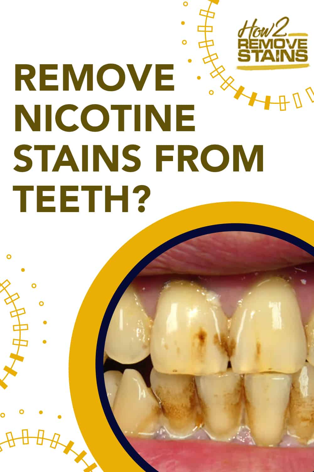 how-to-remove-nicotine-stains-from-teeth-detailed-answer